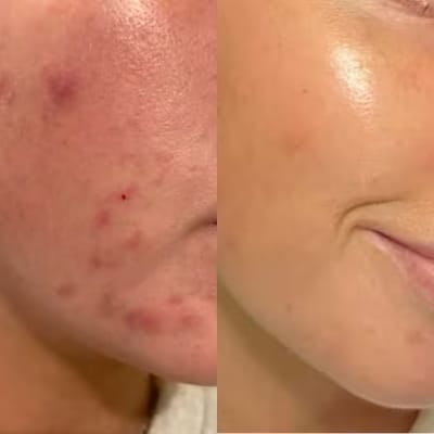 PAULA’S CHOICE – 2% BHA Liquid Exfoliant_img_4